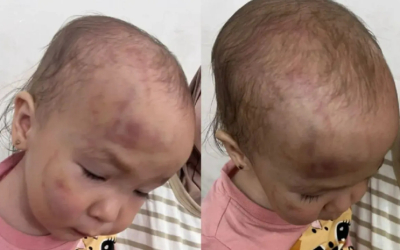 Мать избитого ребенка обвиняет следствие в бездействии в Актау